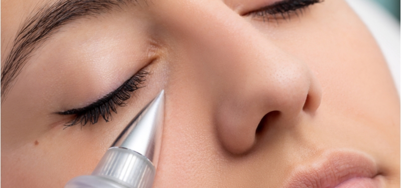 Visage Aesthetics - Plasma Pen 1