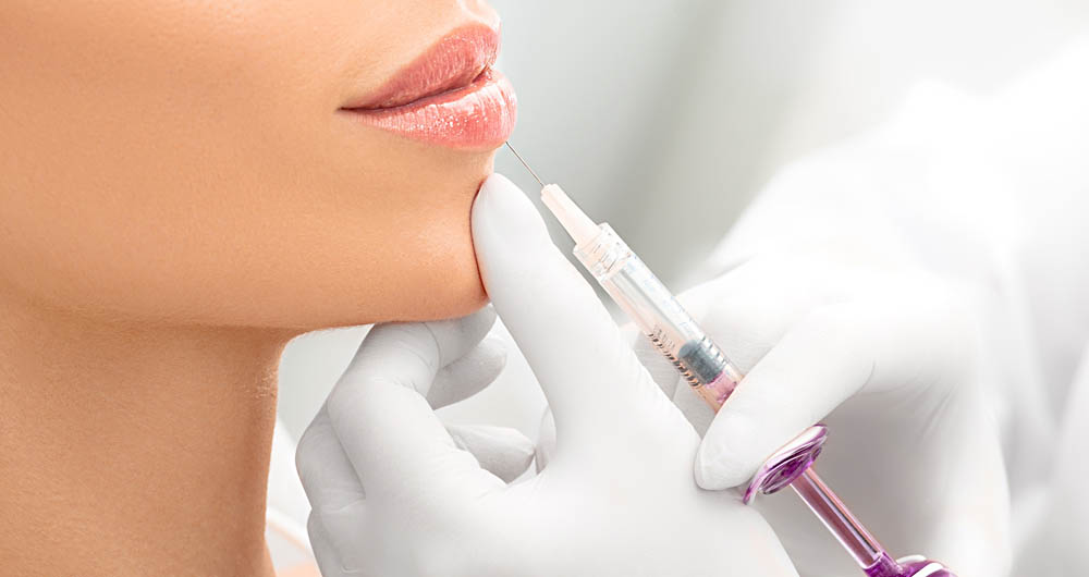 Lip Fillers