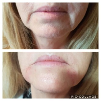Visage Aesthetics - Chorley - Additional Services 3